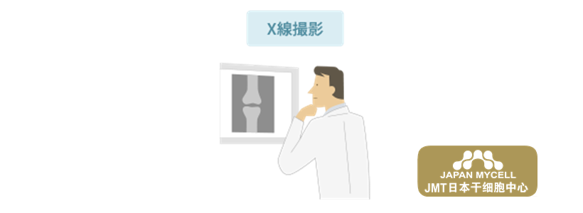 JMT日本干细胞治疗变形性膝关节-变形性膝关节病引起的疼痛