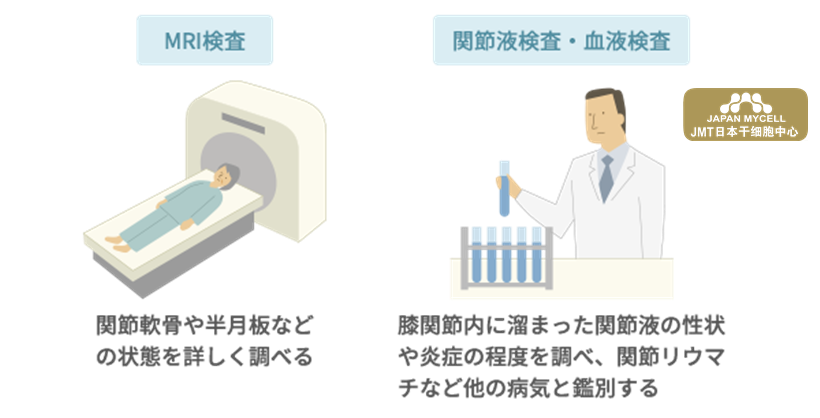 JMT日本干细胞治疗变形性膝关节-变形性膝关节病引起的疼痛