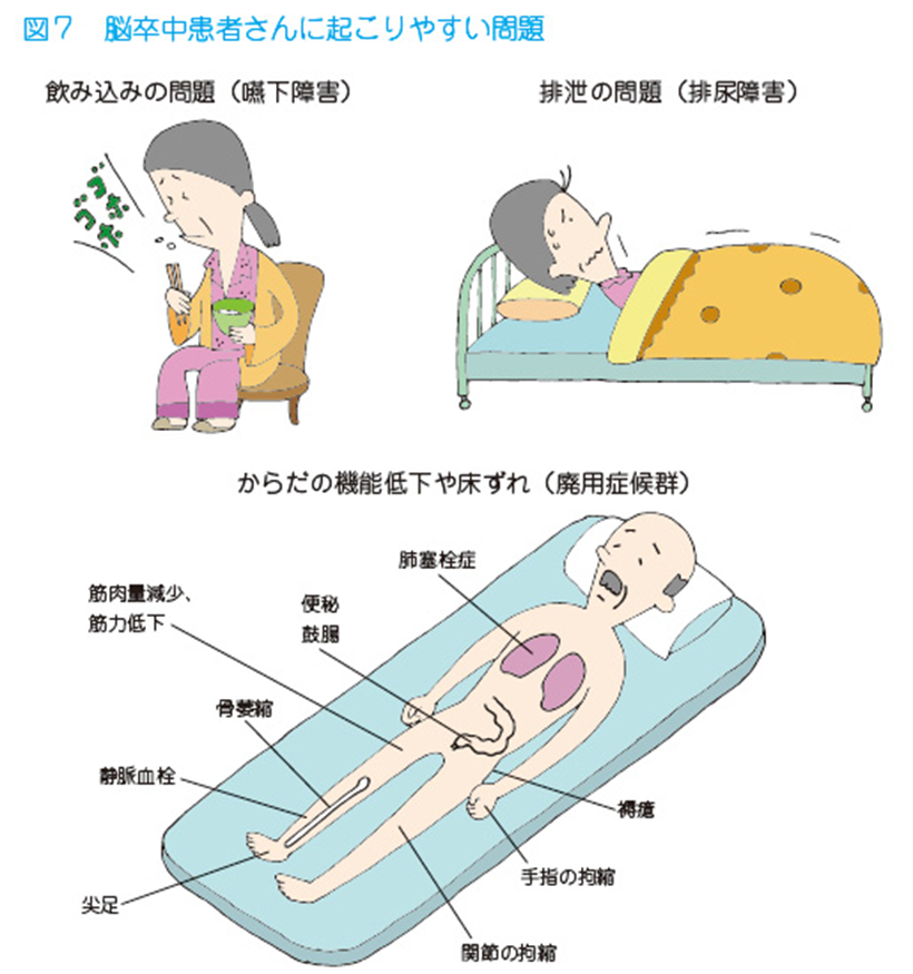 JMT日本干细胞中心-脑梗脑中风脑出血干细胞及其他治疗方法