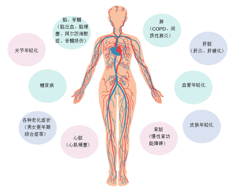 JMT日本干细胞中心-脑梗脑中风脑出血干细胞及其他治疗方法