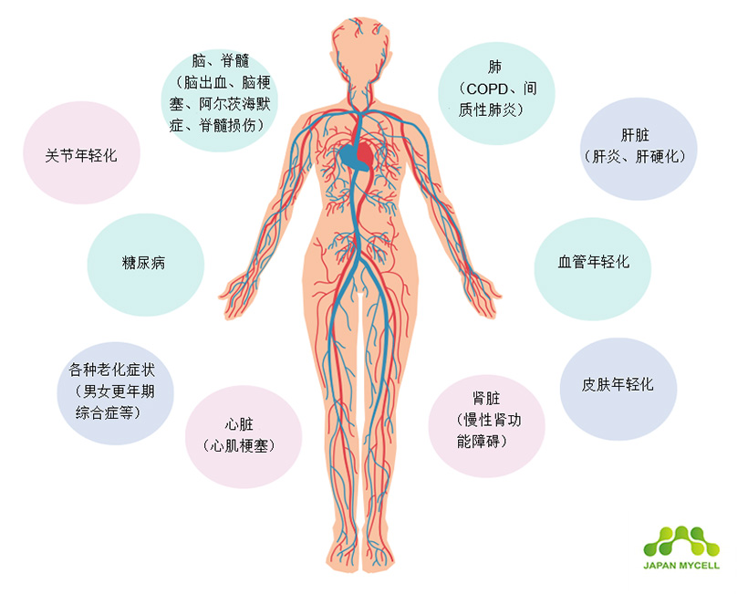 JMT日本干细胞-再生医疗中干细胞的优势和劣势