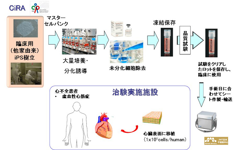 JMT日本IPS干细胞-IPS心肌细胞移植的临床研究的现状是？