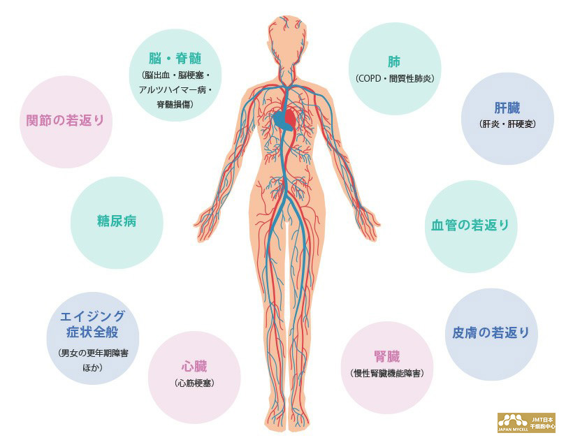 JMT日本干细胞治疗疾病-干细胞对死亡率最高的三大疾病治疗是否有效？