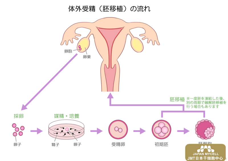 日本经血干细胞--不孕不育的治疗方法及其优缺点，日本经血干细胞治疗卵巢效果如何？