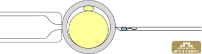 日本经血干细胞-不孕不育的治疗及不孕症的检查