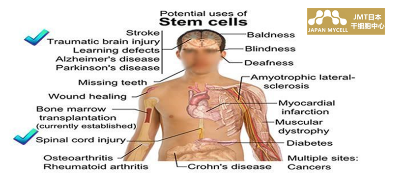JMT日本干细胞中心-干细胞抗衰老