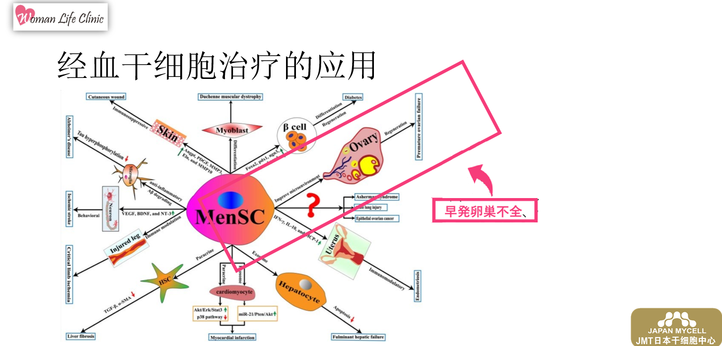 女性更年期、闭经的原因对策及日本经血干细胞的改善治疗