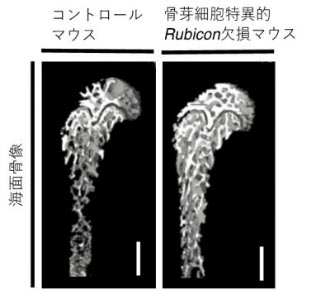 阐明成骨细胞通过自噬活化的机制——自噬抑制骨质疏松症