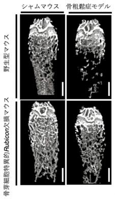 阐明成骨细胞通过自噬活化的机制——自噬抑制骨质疏松症